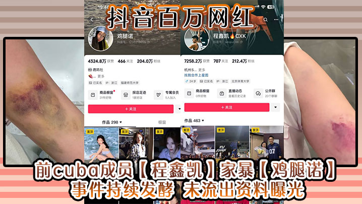 抖音百万网红 前cuba成员【程鑫凯】家暴【鸡腿诺】事件持续发酵 未流出资料曝光!}